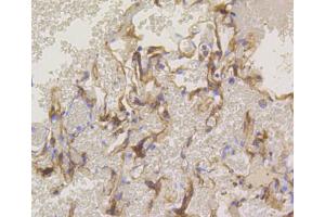 Immunohistochemistry (IHC) image for anti-Protein Kinase C, alpha (PKCa) antibody (ABIN4904772)