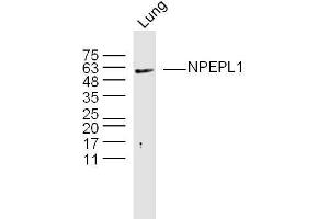 Mouse lung lysates probed with NPEPL1 Polyclonal Antibody, Unconjugated  at 1:300 overnight at 4˚C. (NPEPL1 antibody  (AA 371-470))