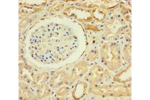 Immunohistochemistry of paraffin-embedded human kidney tissue using ABIN7176159 at dilution of 1:100 (ZNF221 antibody  (AA 1-300))
