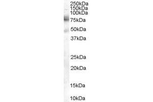 ABIN185579 (2µg/ml) staining of A431 cell lysate (35µg protein in RIPA buffer). (DCP1A antibody  (C-Term))