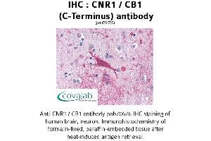 Image no. 1 for anti-Cannabinoid Receptor 1 (CNR1) (C-Term) antibody (ABIN1733176) (CNR1 antibody  (C-Term))