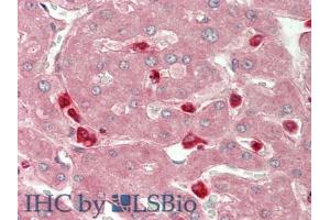 IHC-P analysis of Human Liver Tissue, with HE staining. (CHI3L1 antibody  (AA 112-377))
