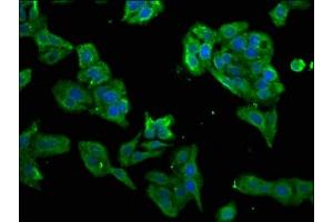 Immunofluorescence staining of HepG2 cells with ABIN7156699 at 1:266, counter-stained with DAPI.