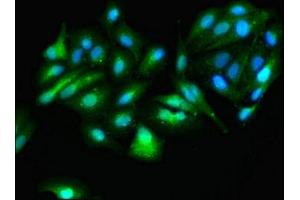 Immunofluorescence staining of HepG2 cells with ABIN7144729 at 1:166, counter-stained with DAPI. (GOT1 antibody  (AA 2-411))