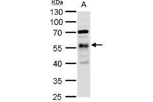 WB Image alpha Tubulin 1A antibody detects alpha Tubulin 1A protein by western blot analysis. (TUBA1A antibody)