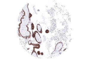 Strong papp A immunostaining of trophoblast cells of a first trimenon placenta (PAPPA antibody  (AA 351-523))