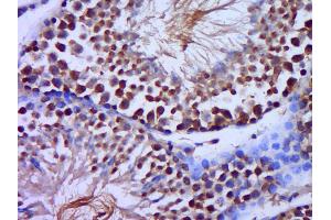 Paraformaldehyde-fixed, paraffin embedded Mouse testis Antigen retrieval by boiling in sodium citrate buffer (pH6. (SCP2D1 antibody  (AA 101-156))