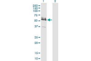 Western Blot analysis of LRRFIP2 expression in transfected 293T cell line by LRRFIP2 MaxPab polyclonal antibody. (LRRFIP2 antibody  (AA 1-400))