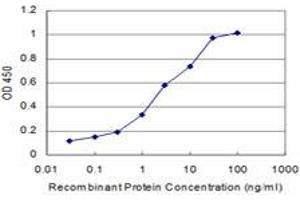 Detection limit for recombinant GST tagged RCV1 is approximately 0. (Recoverin antibody  (AA 101-199))