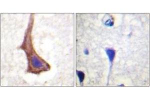 Immunohistochemistry analysis of paraffin-embedded human brain tissue, using CSFR (Ab-561) Antibody. (CSF1R antibody  (AA 531-580))
