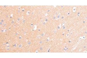 Immunohistochemistry of paraffin-embedded Human brain tissue using CD56 Polyclonal Antibody at dilution 1:30 (CD56 antibody)