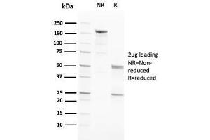 SDS-PAGE Analysis Purified PAPP-A Mouse Monoclonal Antibody (PAPPA/2717).