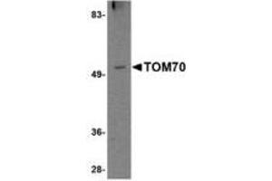 Image no. 1 for anti-Translocase of Outer Mitochondrial Membrane 70 (TOMM70A) (N-Term) antibody (ABIN341709) (TOM70 antibody  (N-Term))