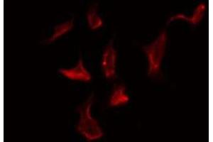 ABIN6278598 staining Hela by IF/ICC. (NOX1 antibody  (C-Term))