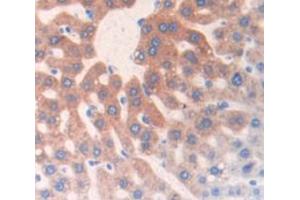 IHC-P analysis of Rat Tissue, with DAB staining. (C3 antibody  (AA 966-1313))
