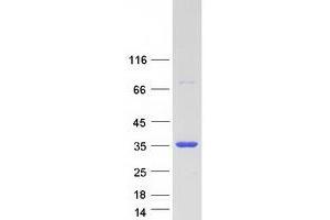 Validation with Western Blot (HIV-1 Tat Interactive Protein 2, 30kDa (HTATIP2) (Transcript Variant 2) protein (Myc-DYKDDDDK Tag))