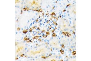 Immunohistochemistry of paraffin-embedded red blood cell staining in rat kidney using Hemoglobin subunit alpha (HB) (HB) Rabbit mAb (ABIN7267608) at dilution of 1:100 (40x lens). (HBA1 antibody)