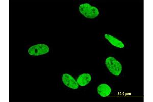 Immunofluorescence of monoclonal antibody to RUNX2 on U-2 OS cell. (RUNX2 antibody  (AA 251-350))