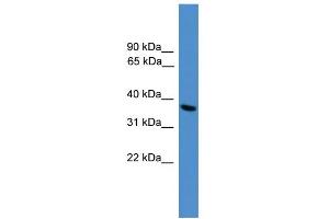 WB Suggested Anti-UCHL5 Antibody Titration: 0. (UCHL5 antibody  (C-Term))