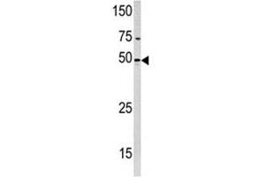 Western blot analysis of PXK antibody and HeLa lysate (PXK antibody  (AA 221-251))
