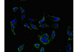 Immunofluorescent analysis of Hela cells using ABIN7157745 at dilution of 1:100 and Alexa Fluor 488-congugated AffiniPure Goat Anti-Rabbit IgG(H+L) (KCNIP4 antibody  (AA 1-250))