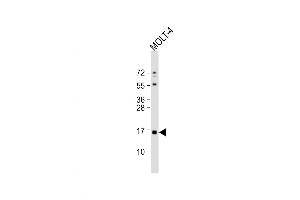 Western Blot at 1:1000 dilution + MOLT-4 whole cell lysate Lysates/proteins at 20 ug per lane. (CRABP1 antibody  (C-Term))