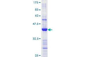 MLH1 Protein (AA 647-756) (GST tag)