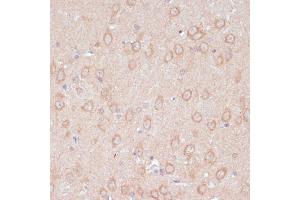 Immunohistochemistry of paraffin-embedded rat brain using D antibody (ABIN7265495) at dilution of 1:100 (40x lens). (ARL4D antibody  (AA 92-201))