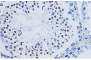 Immunohistochemistry of paraffin-embedded Mouse testis using DiMethyl-Histone H3-K79 Polyclonal Antibody at dilution of 1:200 (40x lens).