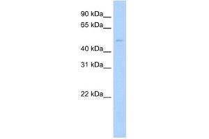 WB Suggested Anti-Pias2 Antibody Titration:  0. (PIAS2 antibody  (C-Term))
