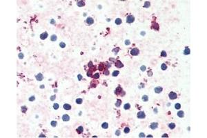 Image no. 1 for anti-Chemokine (C-C Motif) Receptor 4 (CCR4) (C-Term) antibody (ABIN488046) (CCR4 antibody  (C-Term))