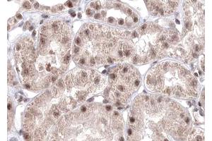 ABIN6267597 at 1/100 staining human liver tissue sections by IHC-P. (NF-kB p65 antibody  (pSer529))