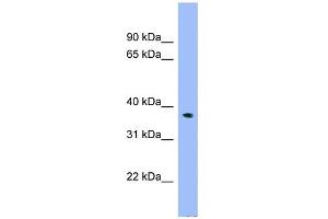 WB Suggested Anti-C17orf48 Antibody Titration: 0. (ADPRM antibody  (N-Term))