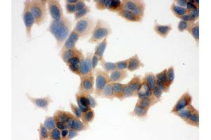 IHC analysis of FASN using anti-FASN antibody . (Fatty Acid Synthase antibody  (AA 1-226))