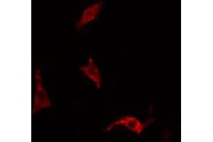 ABIN6266468 staining HepG2 cells by IF/ICC. (EPS15 antibody  (pTyr849))