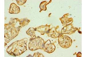 Immunohistochemistry of paraffin-embedded human placenta tissue using ABIN7145226 at dilution of 1:100 (BAG5 antibody  (AA 198-447))