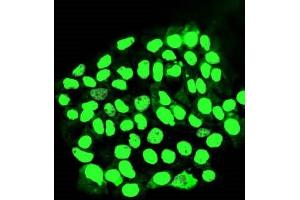 IF analysis of MORC3 using anti-MORC3 antibody (ABIN7602764).