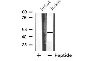 Western blot analysis of extracts from Jurkat cells, using MATK antibody. (MATK antibody  (Internal Region))