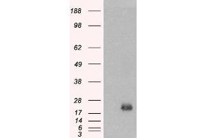 HEK293 overexpressing BAALC and probed with ABIN2561308 (mock transfection in first lane). (BAALC antibody  (Internal Region))