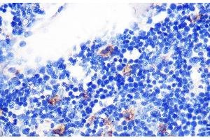 Immunohistochemistry of paraffin-embedded Rat bone marrow using TGFB1 Polyclonal Antibody at dilution of 1:100 (40x lens). (TGFB1 antibody)