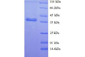 SDS-PAGE (SDS) image for Apolipoprotein E (APOE) (AA 19-311) protein (His tag) (ABIN5709069)