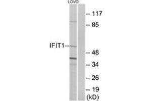 Western blot analysis of extracts from LOVO cells, using IFIT1 Antibody. (IFIT1 antibody  (AA 41-90))