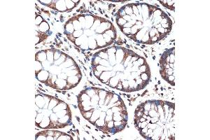 Immunohistochemistry of paraffin-embedded human colon using SMURF2 Rabbit mAb (ABIN1680578, ABIN3015927, ABIN3015928 and ABIN7101462) at dilution of 1:100 (40x lens). (SMURF2 antibody)