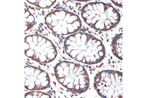 Immunohistochemistry of paraffin-embedded human colon using SMURF2 Rabbit mAb (ABIN1680578, ABIN3015927, ABIN3015928 and ABIN7101462) at dilution of 1:100 (40x lens). (SMURF2 antibody)