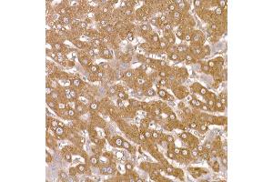 Immunohistochemistry (IHC) image for anti-Numb Homolog (NUMB) (AA 521-640) antibody (ABIN6144943)