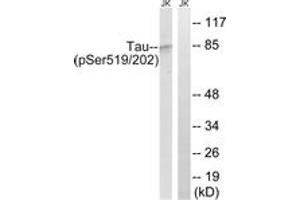 Western blot analysis of extracts from Jurkat cells treated with H2O2 100uM 30', using Tau (Phospho-Ser519/202) Antibody. (tau antibody  (pSer519))