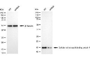 Western blotting analysis using cellular retinoic acid binding protein 1 antibody (ABIN7798021).