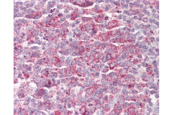 MRPL23 antibody