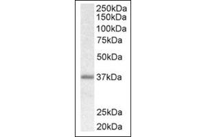 Image no. 1 for anti-Biglycan (BGN) (C-Term) antibody (ABIN375174) (Biglycan antibody  (C-Term))