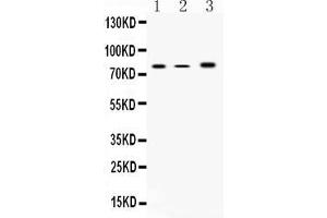 Western blot analysis of 12 Lipoxygenase using anti-12 Lipoxygenase antibody . (ALOX12 antibody  (N-Term))